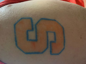 David Nichols' love for Syracuse basketball is proudly displayed on his arm.